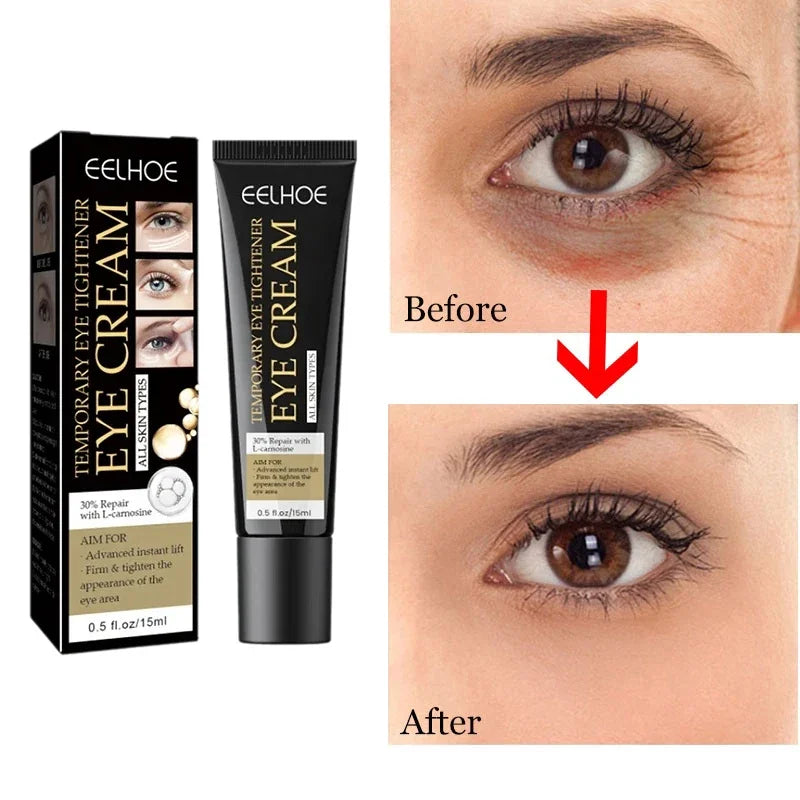 Tighten Wrinkles Eye Cream Remove Eye Fat Bags Puffiness