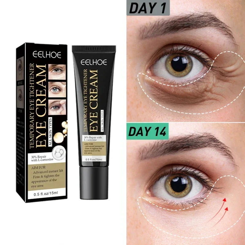 Tighten Wrinkles Eye Cream Remove Eye Fat Bags Puffiness