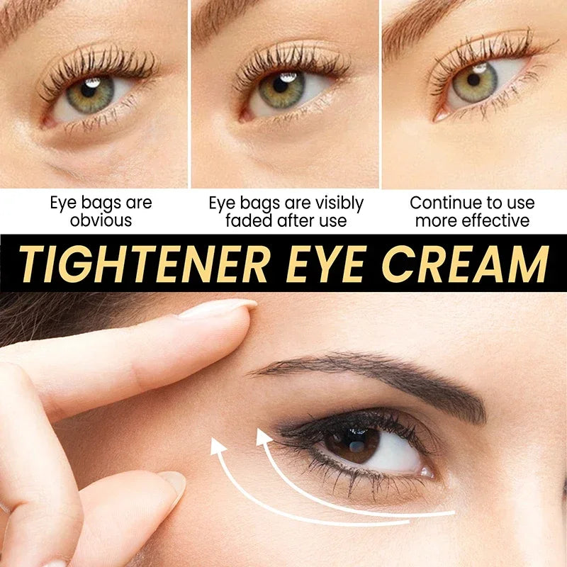 Tighten Wrinkles Eye Cream Remove Eye Fat Bags Puffiness