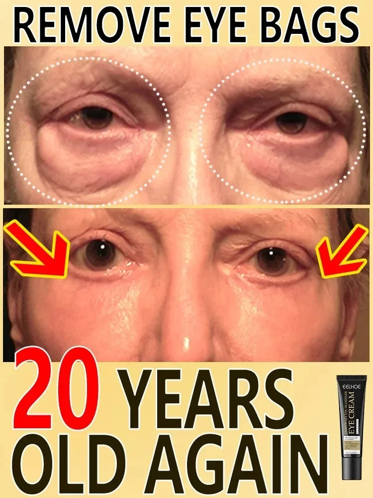 Tighten Wrinkles Eye Cream Remove Eye Fat Bags Puffiness